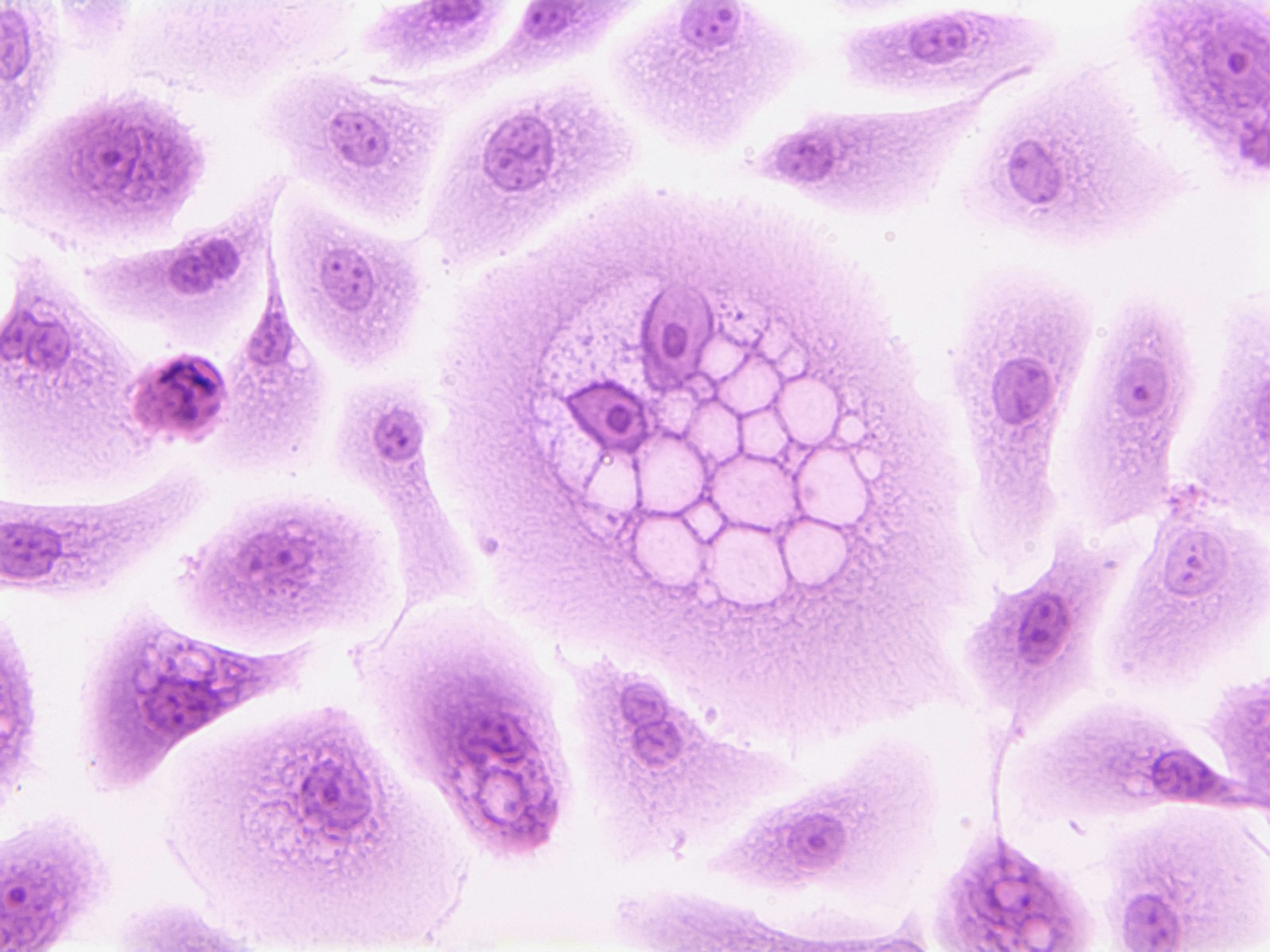 FIT Test for Bowel Cancer